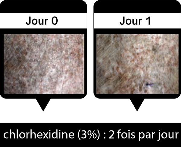 Jour0-Jour1
