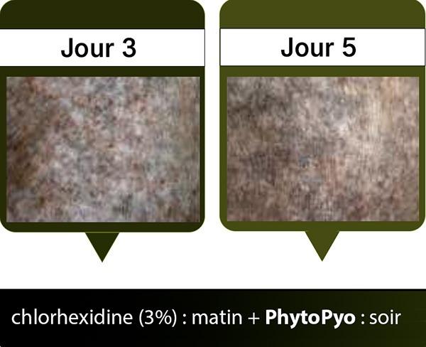 Jour3-Jour5